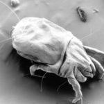 Can Dust Mites Kill You?