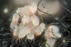 How Common Is Dust Mite Allergy