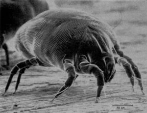 Can Dust Mites Cause Skin Rashes